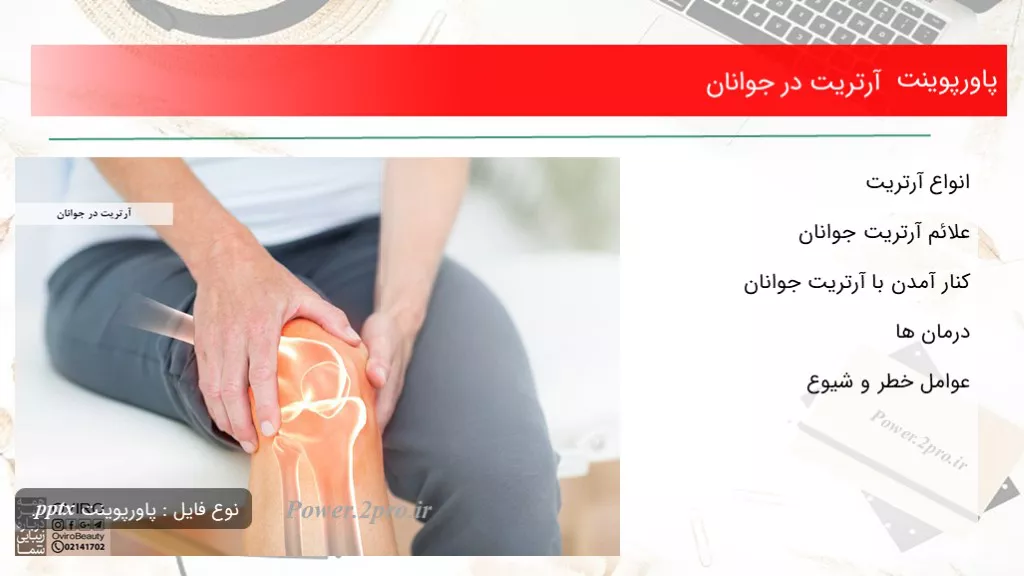 دانلود پاورپوینت آرتریت در جوانان - کد106741