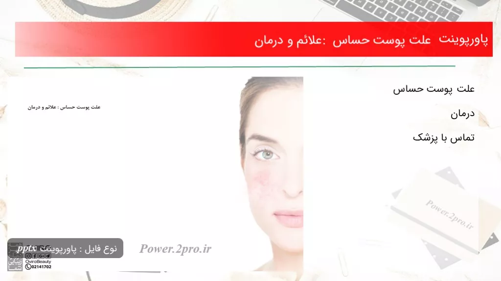 دانلود پاورپوینت چرایی پوست حساس : علائم و درمان - کد106815