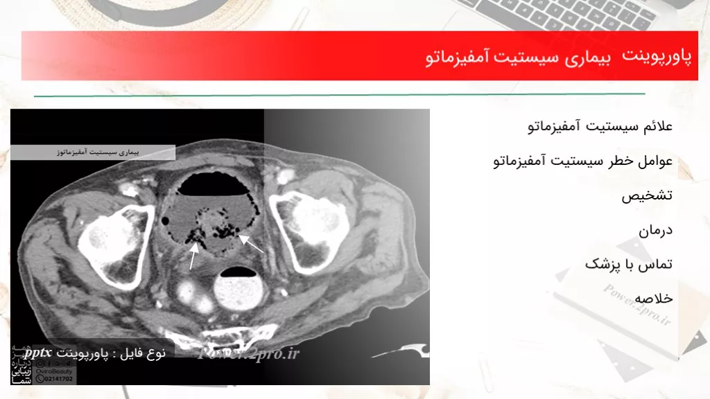 دانلود پاورپوینت بیماری سيستيت آمفيزماتو - کد106892