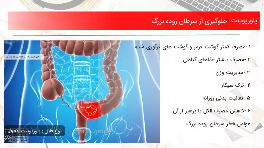 دانلود پاورپوینت جلوگیری از سرطان روده بزرگ - کد106981