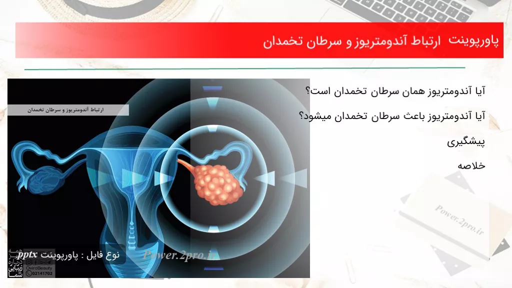 دانلود پاورپوینت بستگی آندومتریوز و سرطان تخمدان - کد107070