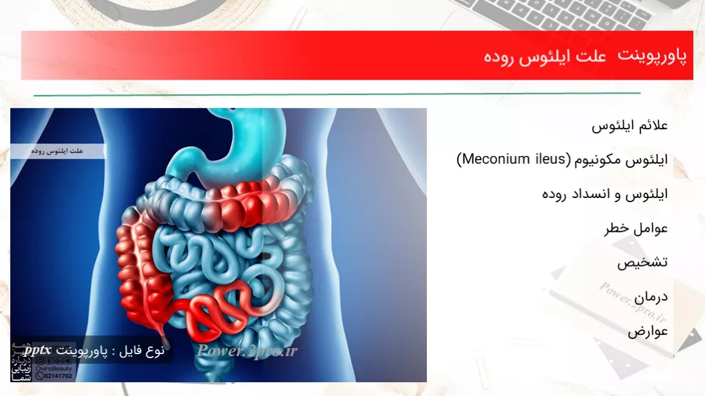 دانلود پاورپوینت چرایی ایلئوس روده - کد107080