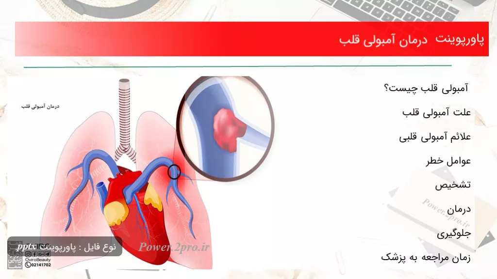 دانلود پاورپوینت درمان آمبولی قلب - کد107081