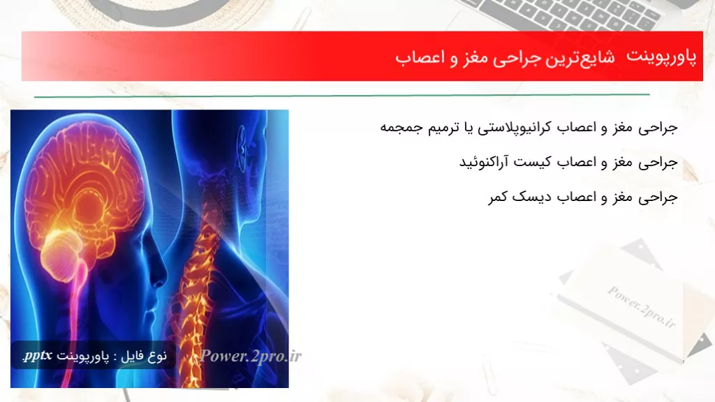 شایع‌ترین جراحی مغز و اعصاب