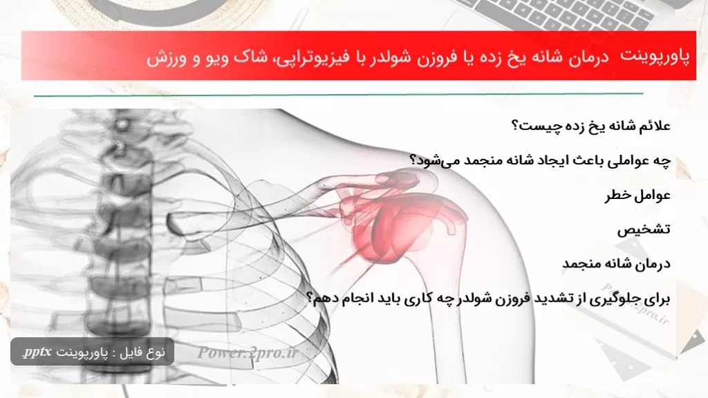 دانلود پاورپوینت درمان شانه یخ زده یا فروزن شولدر با فیزیوتراپی، شاک ویو و ورزش - کد107475