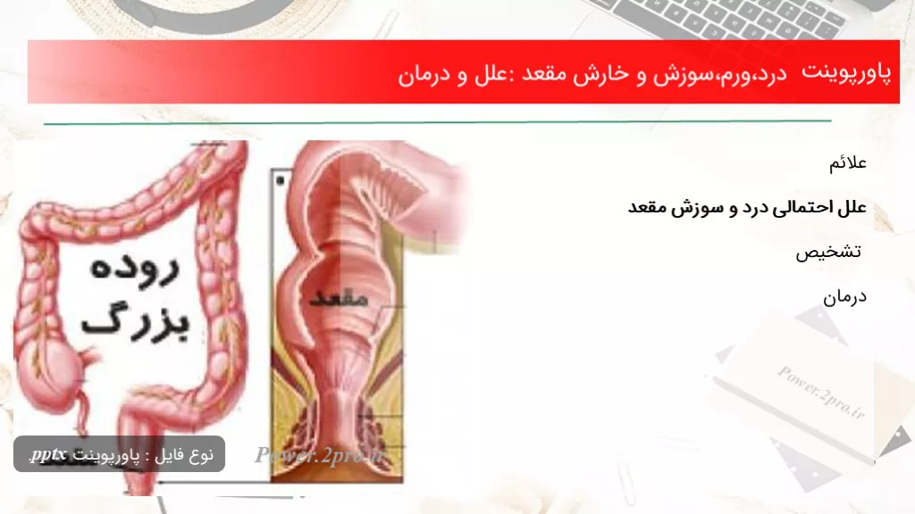 دانلود پاورپوینت درد،ورم،سوزش و خارش مقعد: علل و درمان - کد107483