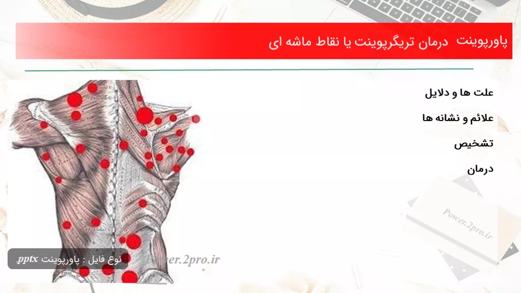 دانلود پاورپوینت درمان تریگرپوینت یا نقاط ماشه ای - کد107485