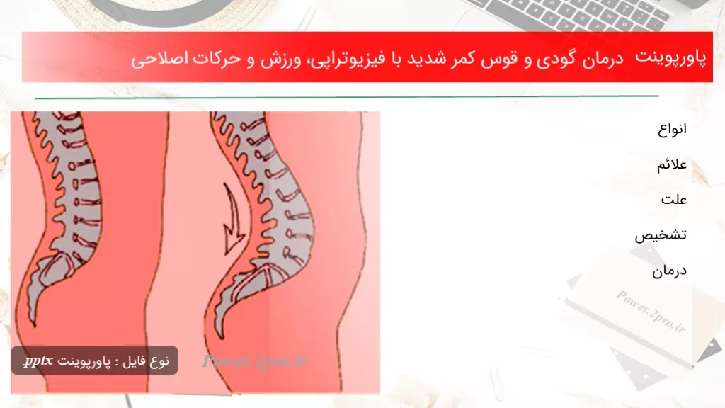 دانلود پاورپوینت درمان گودی و قوس کمر شدید با فیزیوتراپی، ورزش و حرکات اصلاحی - کد107492