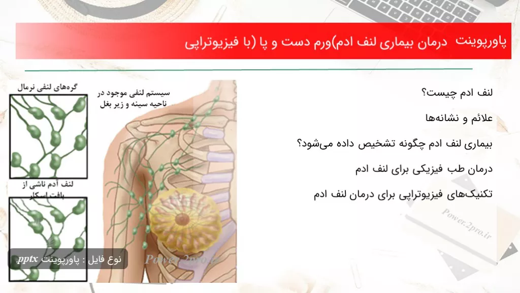 درمان بیماری لنف ادم(ورم دست و پا) با فیزیوتراپی