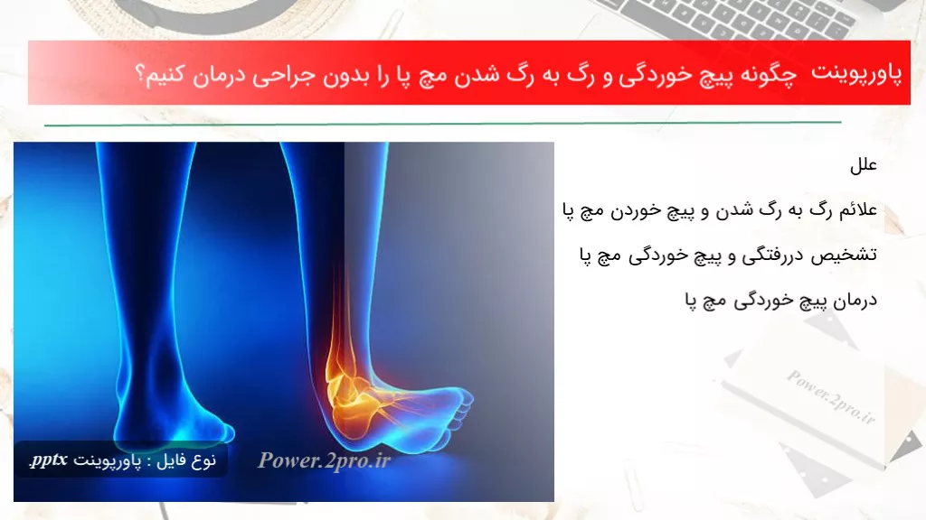 دانلود پاورپوینت چطور پیچ خوردگی و رگ به رگ شدن مچ پا را بدون جراحی درمان کنیم؟ - کد107565