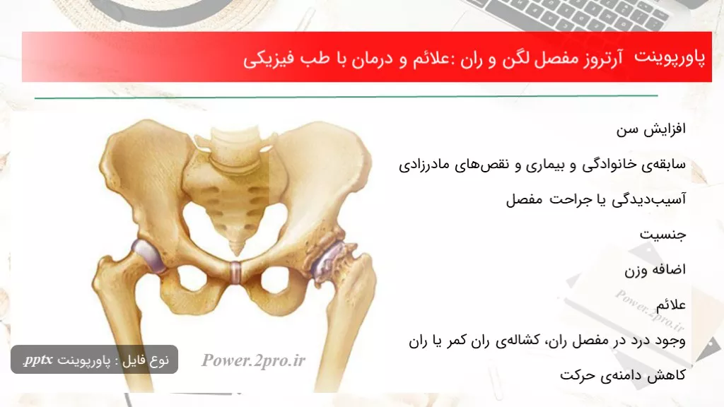 آسیب دیدگی مفصل ران