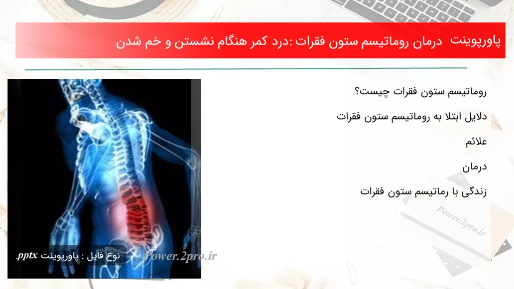 دانلود پاورپوینت درمان روماتیسم ستون فقرات: درد کمر هنگام نشستن و خم شدن - کد107644