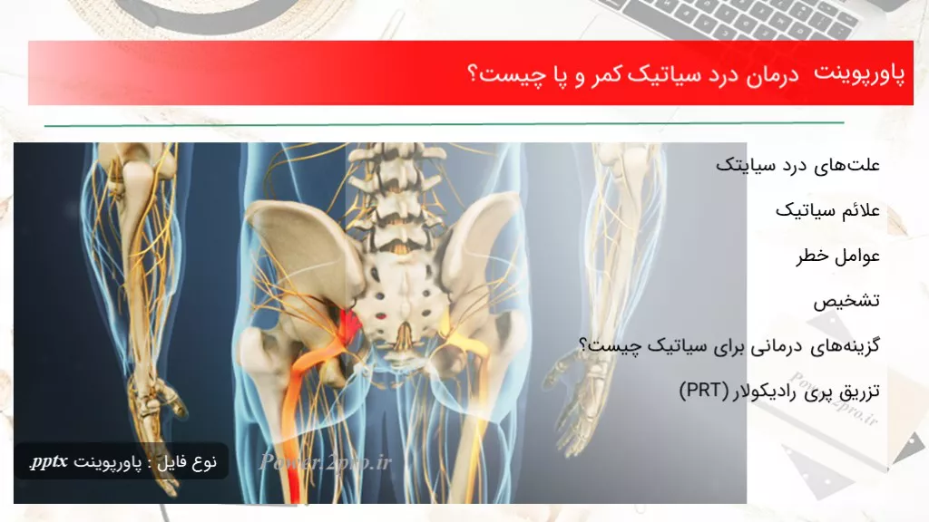 دانلود پاورپوینت درمان درد سیاتیک کمر و پا چه چیزی است ؟ - کد107647