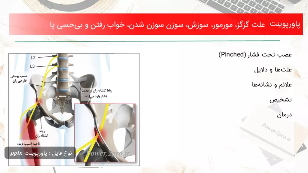 دانلود پاورپوینت چرایی گزگز، مورمور، سوزش، سوزن سوزن شدن، خواب رفتن و بی‌حسی پا - کد107654