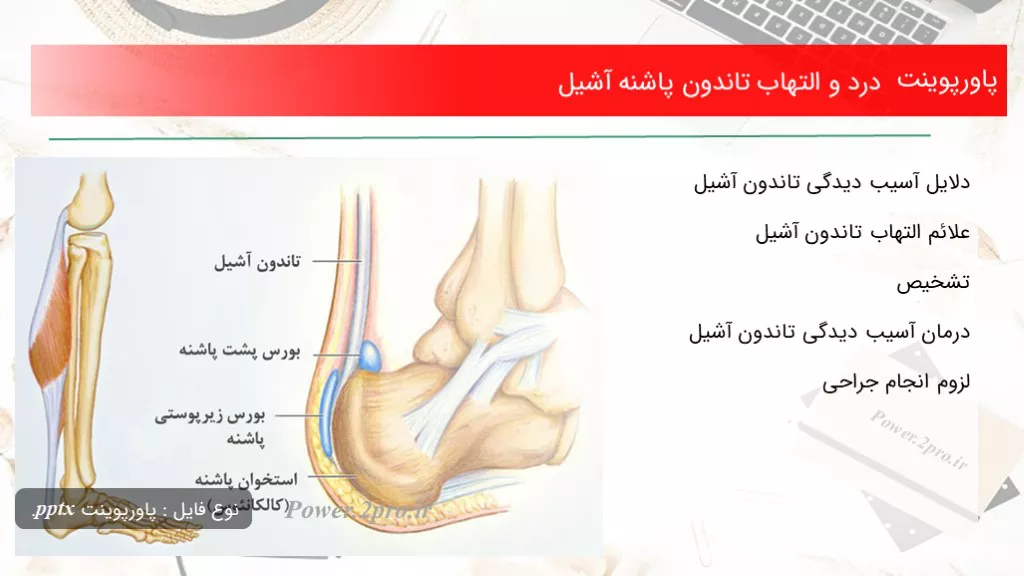 دانلود پاورپوینت درد و التهاب تاندون پاشنه آشیل - کد107665