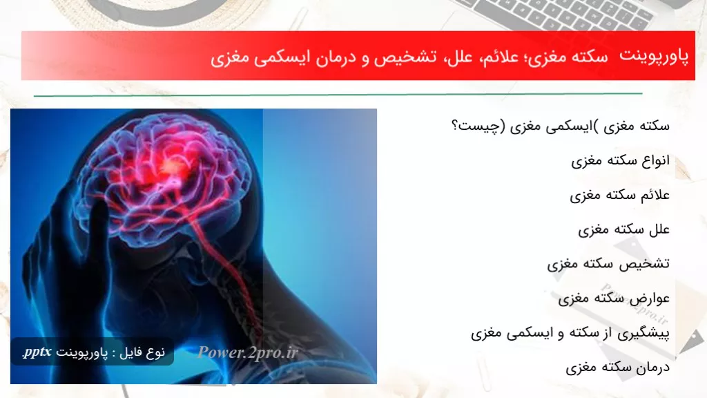 دانلود پاورپوینت سکته مغزی؛ علائم، علل، تشخیص و درمان ایسکمی مغزی - کد107677