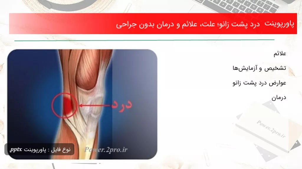 دانلود پاورپوینت درد پشت زانو؛ چرایی ، علائم و درمان بدون جراحی - کد107689