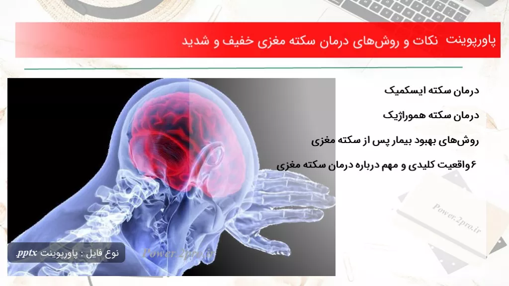 نکات و روش‌های درمان سکته مغزی خفیف و شدید