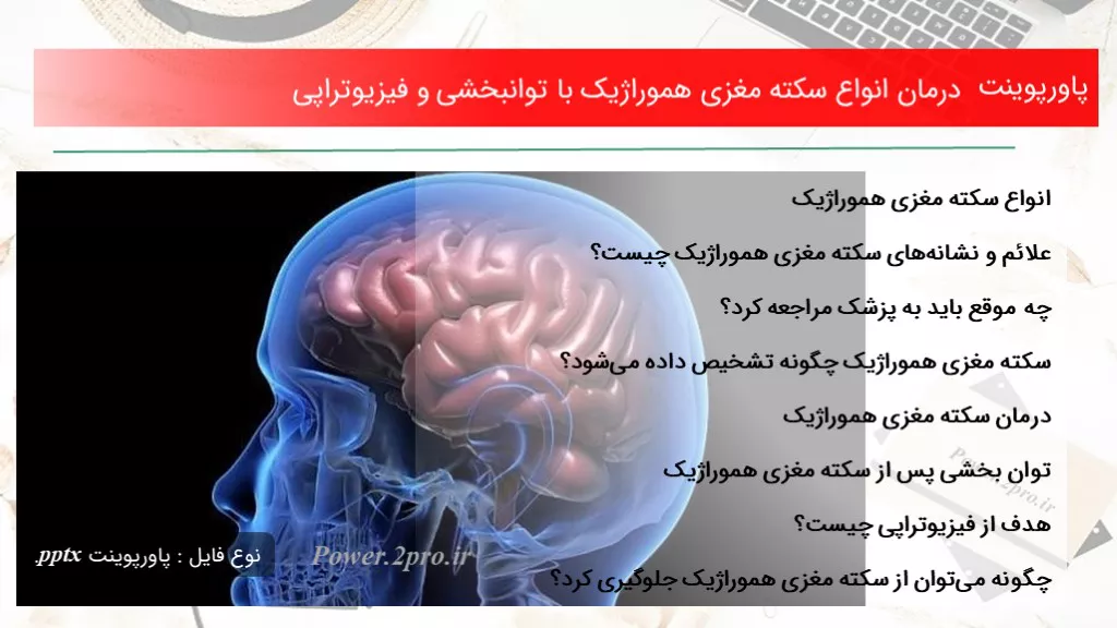 دانلود پاورپوینت درمان انواع سکته مغزی هموراژیک با توانبخشی و فیزیوتراپی - کد107719