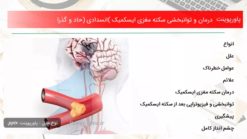 دانلود پاورپوینت درمان و توانبخشی سکته مغزی ایسکمیک (انسدادی) حاد و گذرا - کد107723