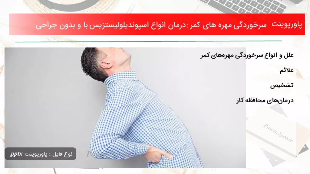 دانلود پاورپوینت سرخوردگی مهره های کمر: درمان انواع اسپوندیلولیستزیس با و بدون جراحی - کد107727