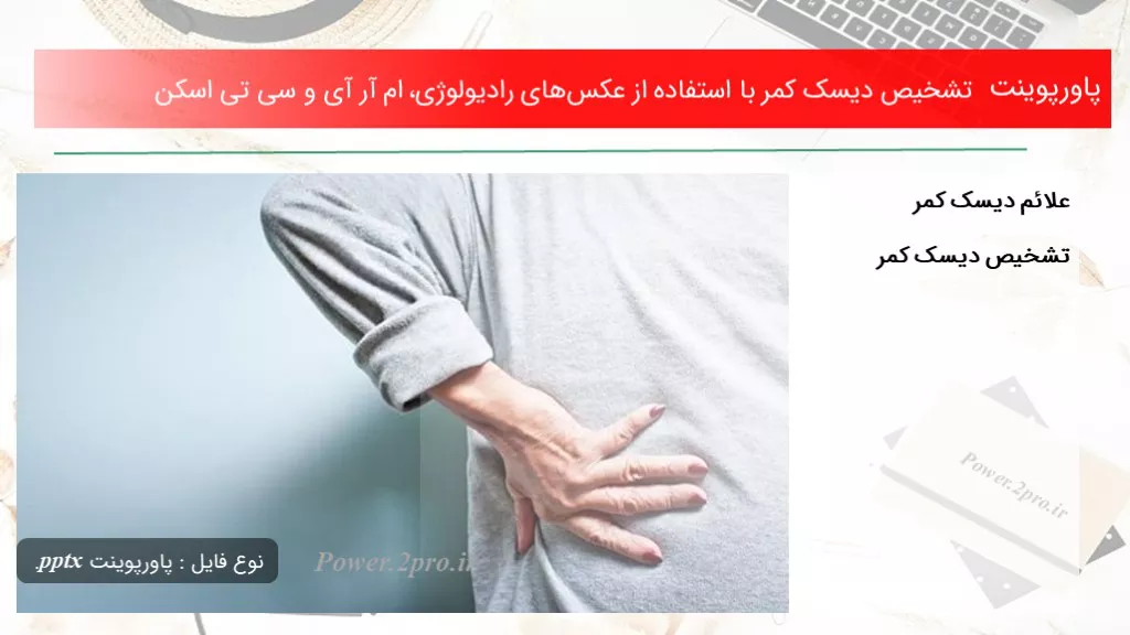 تشخیص دیسک کمر با استفاده از عکس‌های رادیولوژی، ام آر آی و سی تی اسکن