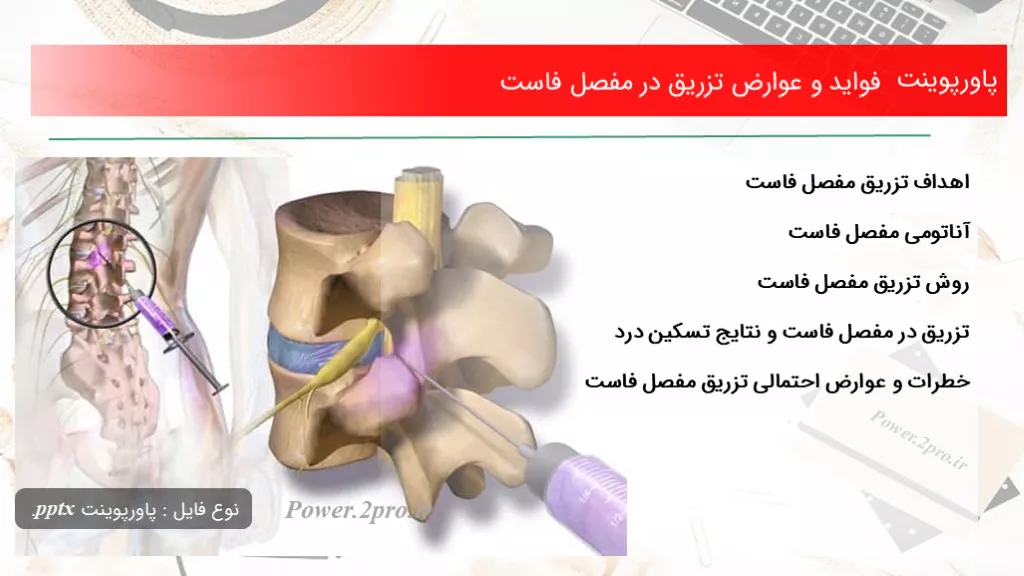 دانلود پاورپوینت فواید و عوارض تزریق در مفصل فاست - کد107807