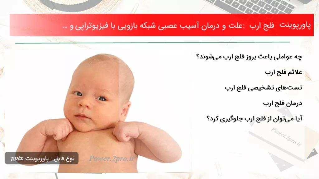 فلج اعصاب محیطی