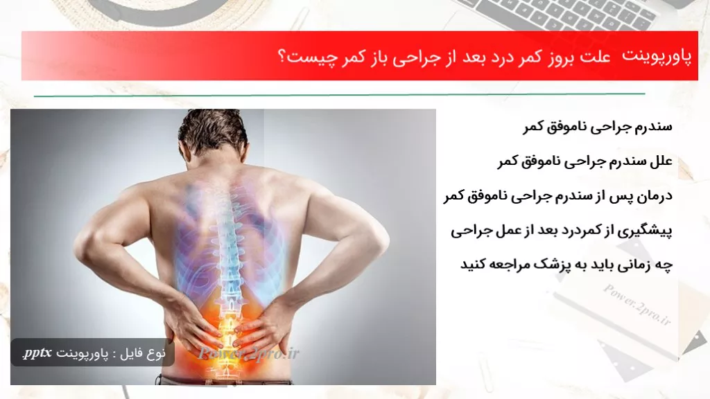 دانلود پاورپوینت چرایی بروز کمر درد بعد از جراحی باز کمر چه چیزی است ؟ - کد107844