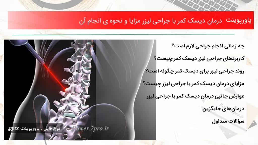 درمان دیسک کمر با جراحی لیزر مزایا و نحوه ی انجام آن