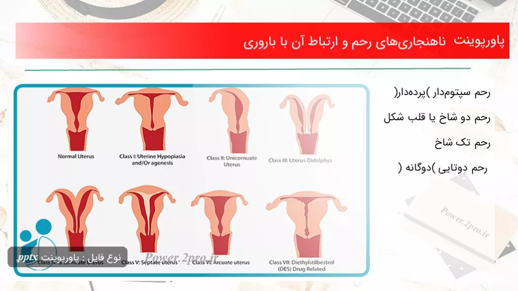 دانلود پاورپوینت ناهنجاری‌های رحم و بستگی آن با باروری - کد107861