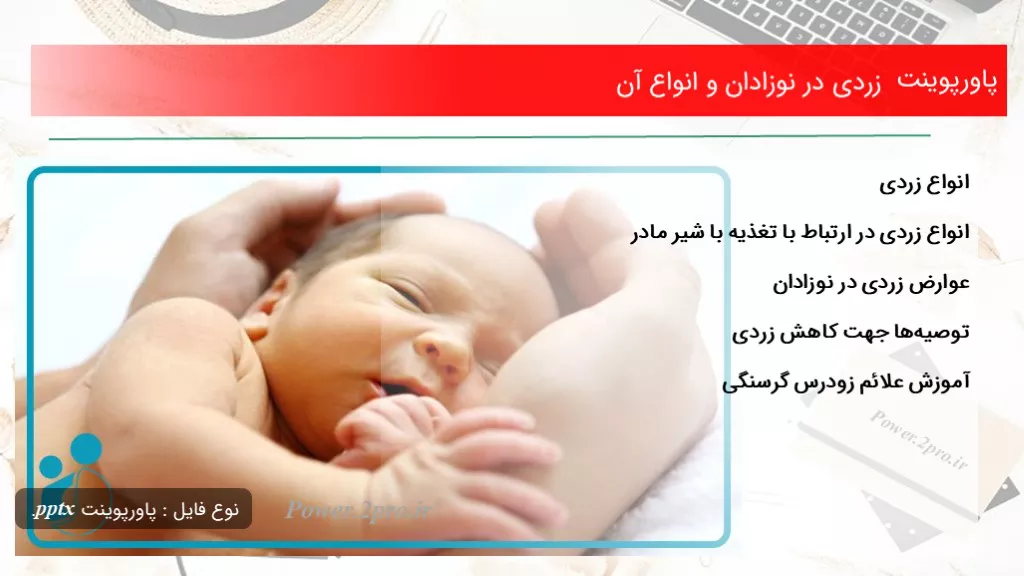 زردی در نوزادان و انواع آن