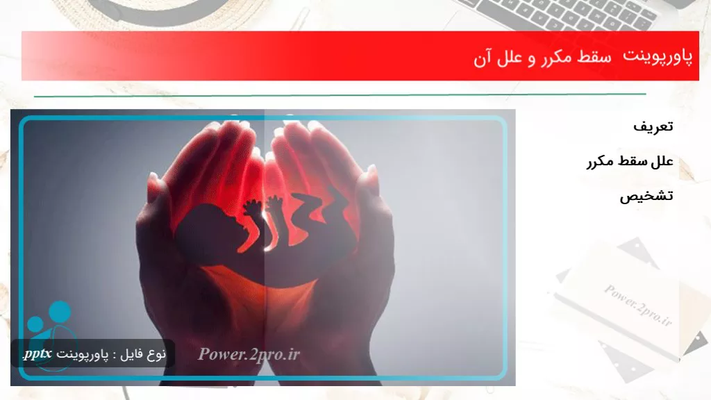 دانلود پاورپوینت سقط مکرر و علل آن - کد107885