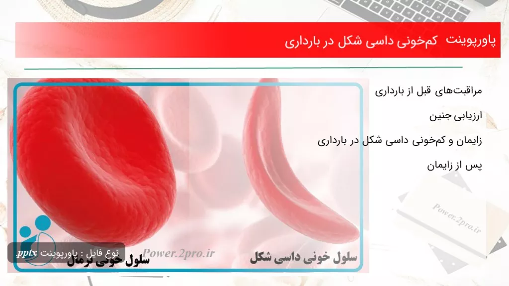 دانلود پاورپوینت کم‌خونی داسی شکل در بارداری - کد107888