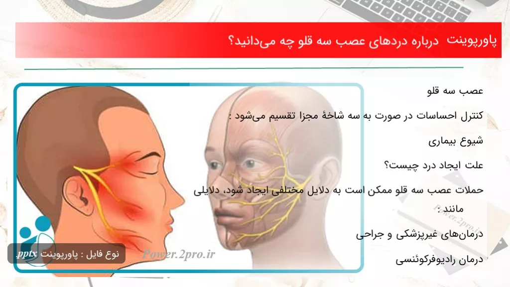 دانلود پاورپوینت درزمینه دردهای عصب سه قلو چه می‌دانید؟ - کد107901