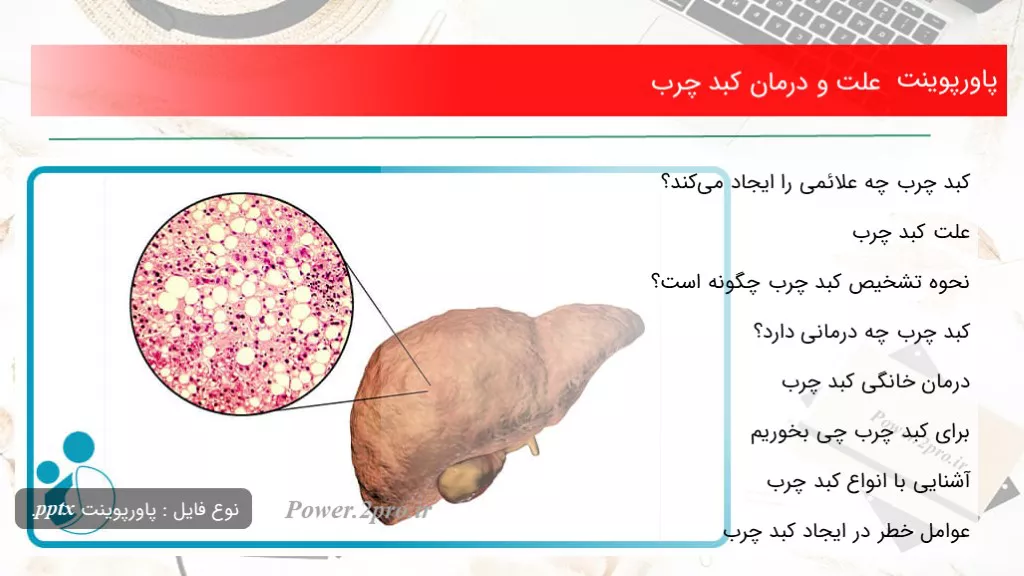 دانلود پاورپوینت چرایی و درمان کبد چرب - کد107924