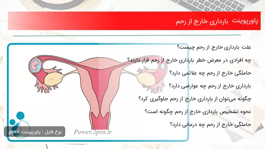 بارداری خارج از رحم