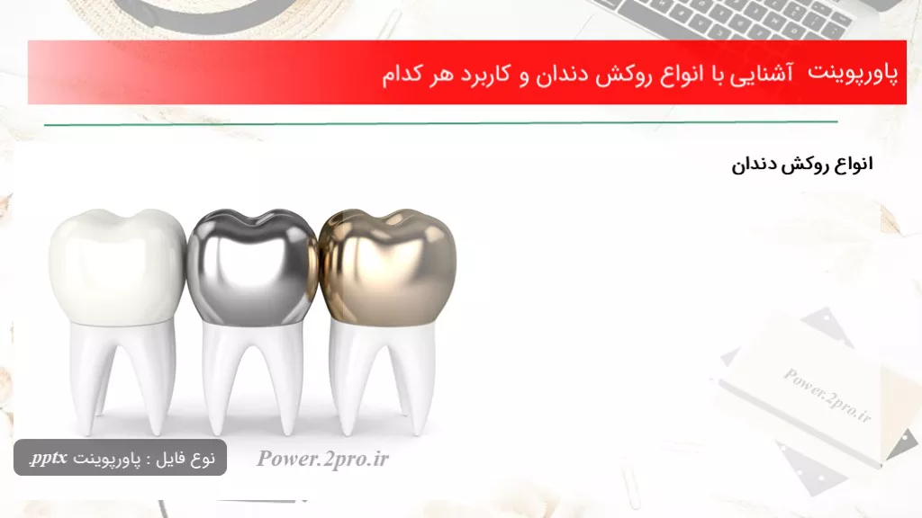 روکش دندان و انواع آن و توضیح جنس هریک