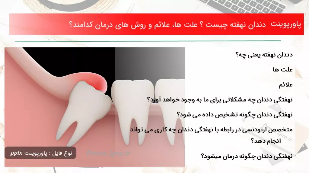 دندان نهفته چیست ؟ علت ها، علائم و روش های درمان کدامند؟