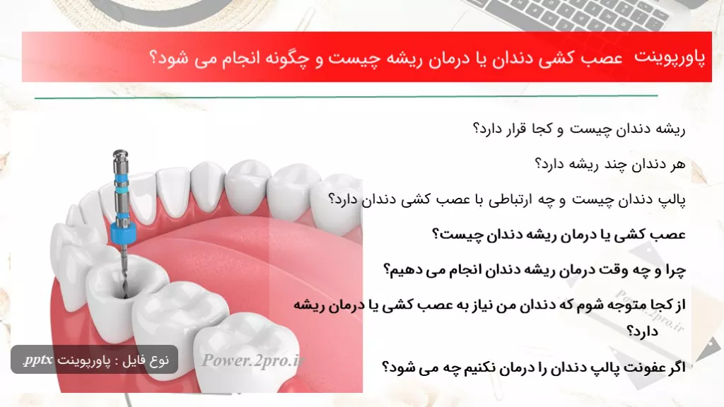 عصب کشی دندان یا درمان ریشه چیست و چگونه انجام می شود؟