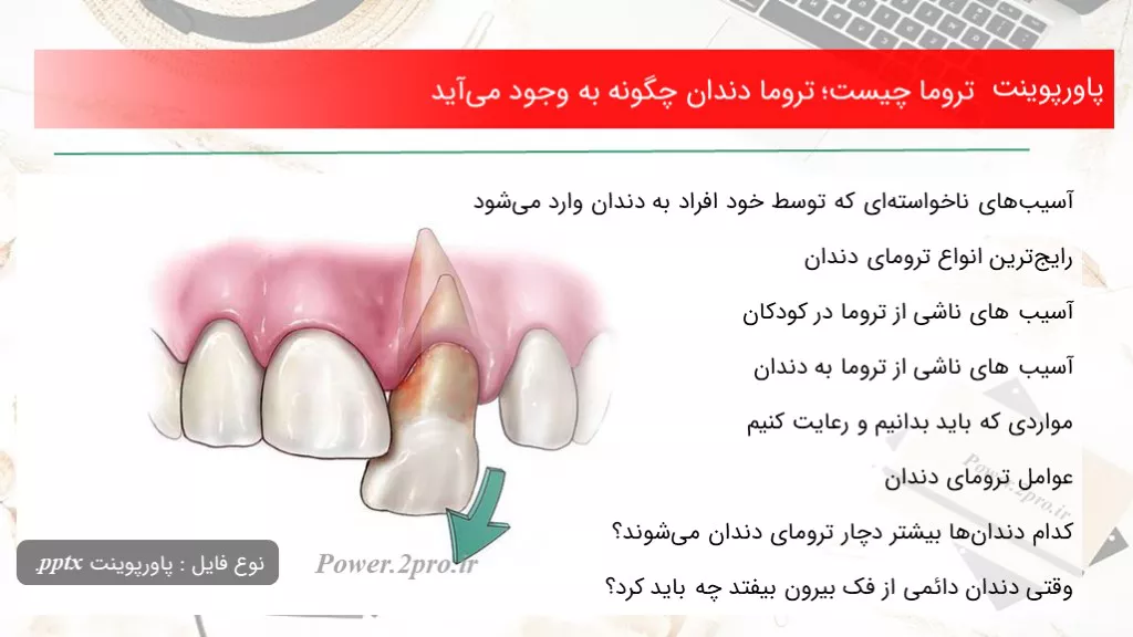 دانلود پاورپوینت تروما چه چیزی است ؛ تروما دندان چطور به وجود می‌آید - کد108010