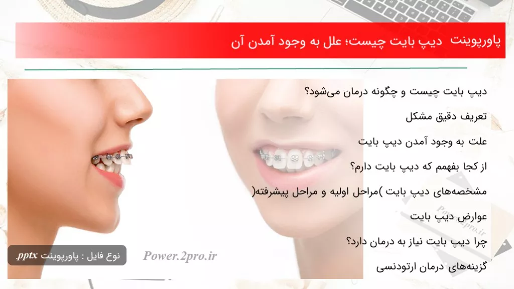 دانلود پاورپوینت دیپ بایت چه چیزی است ؛ علل به وجود آمدن آن - کد108012