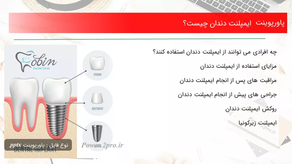 ایمپلنت دندان چیست؟