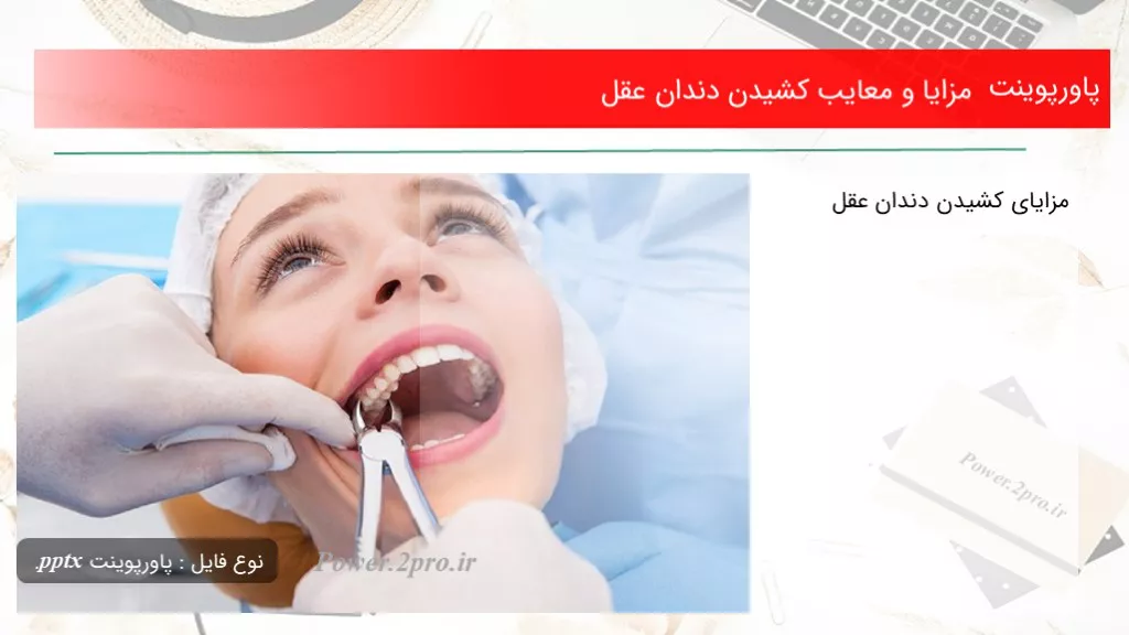 دانلود پاورپوینت مزایا و معایب کشیدن دندان عقل - کد108028