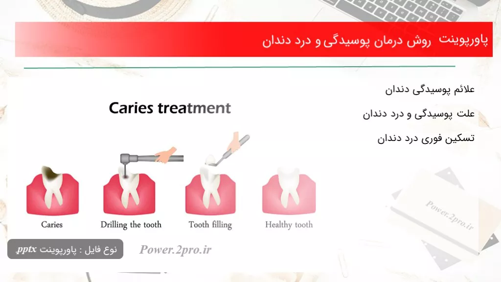 دانلود پاورپوینت چگونگی درمان پوسیدگی و درد دندان - کد108035