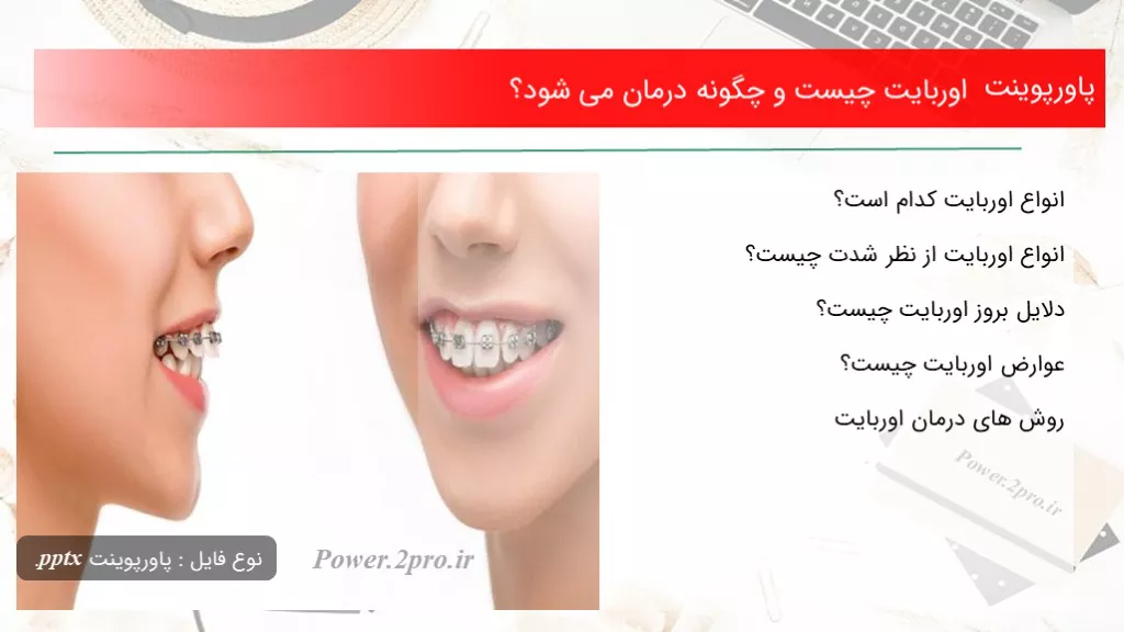 دانلود پاورپوینت اوربایت چه چیزی است و چطور درمان می شود؟ - کد108041