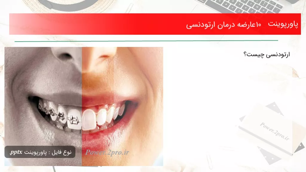 دانلود پاورپوینت 10 عارضه درمان ارتودنسی - کد108042