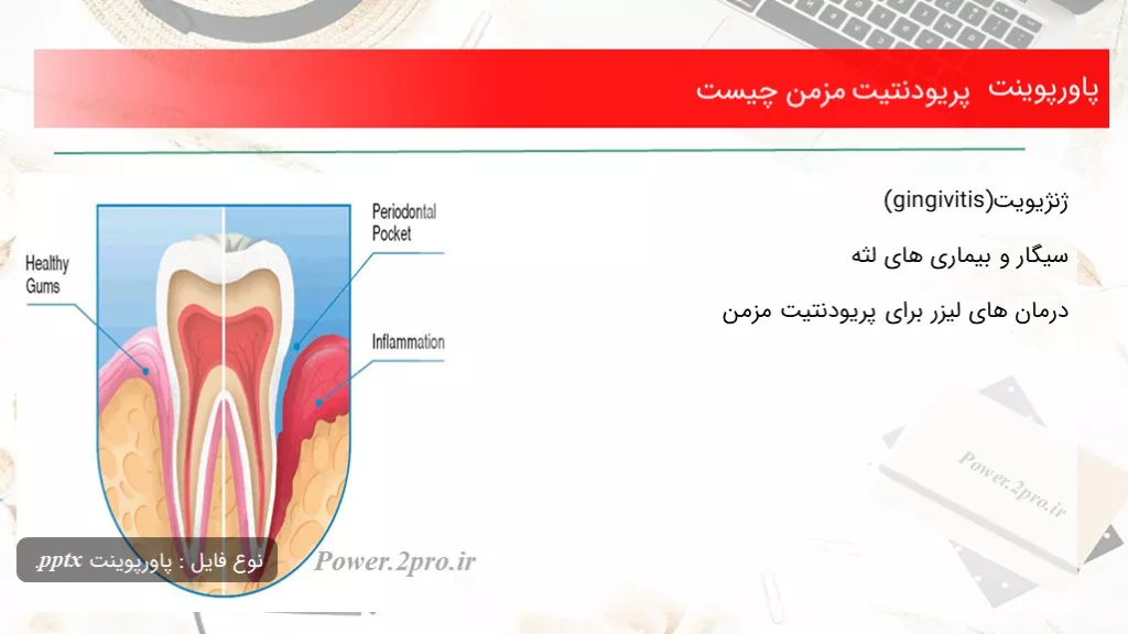 بیماری های پریودنتال چیست