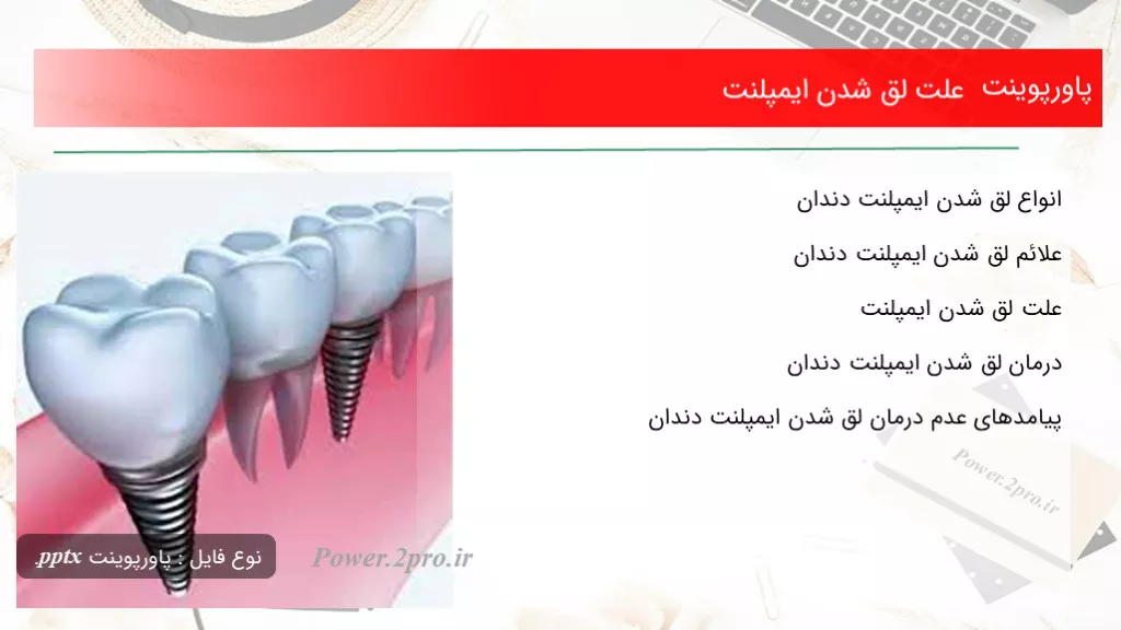 دانلود پاورپوینت چرایی لق شدن ایمپلنت - کد108050