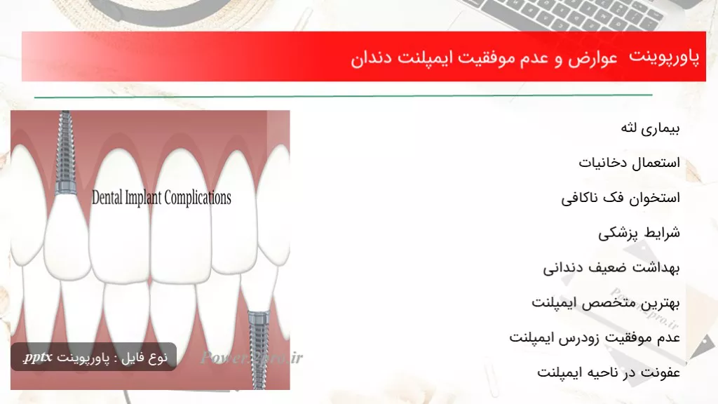 دانلود پاورپوینت عوارض و عدم موفقیت ایمپلنت دندان - کد108112